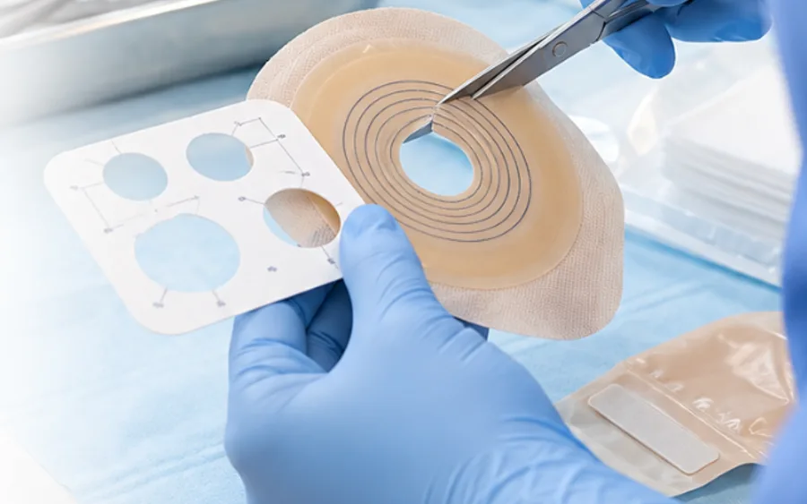 Manejo Especializado de Ostomías y Heridas